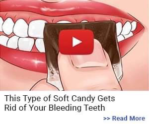 This candy heals your bleeding teeth